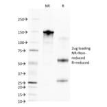 SDS-PAGE - Anti-CD68 Antibody [C68/2709] (A250766) - Antibodies.com