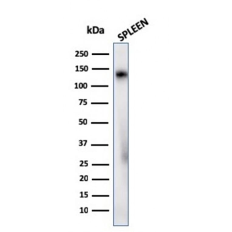 Western Blot - Anti-CD68 Antibody [C68/2908R] (A250767) - Antibodies.com