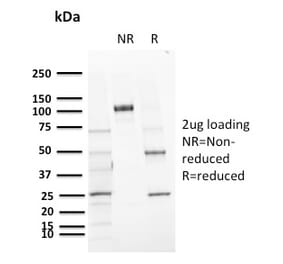 SDS-PAGE - Anti-CD72 Antibody [BU40] (A250770) - Antibodies.com