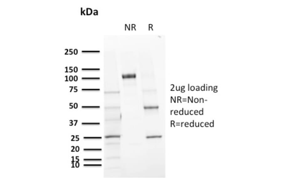 SDS-PAGE - Anti-CD72 Antibody [BU40] (A250770) - Antibodies.com