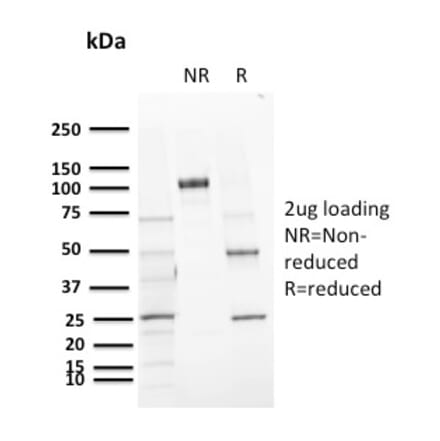 SDS-PAGE - Anti-CD72 Antibody [BU40] (A250770) - Antibodies.com