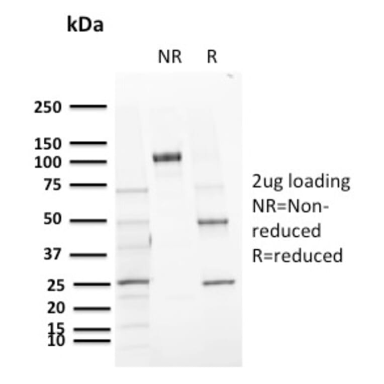 SDS-PAGE - Anti-CD72 Antibody [BU40] (A250770) - Antibodies.com