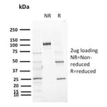 SDS-PAGE - Anti-CD72 Antibody [BU40] (A250770) - Antibodies.com