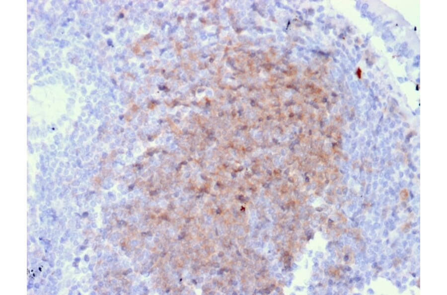 Immunohistochemistry - Anti-CD72 Antibody [BU40] (A250770) - Antibodies.com