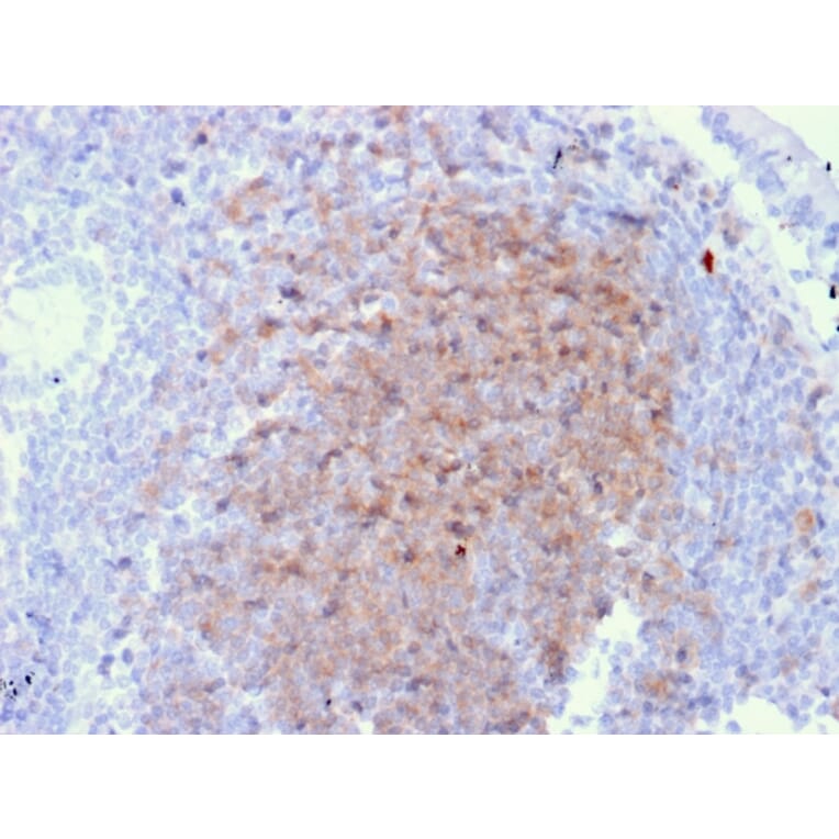 Immunohistochemistry - Anti-CD72 Antibody [BU40] (A250770) - Antibodies.com