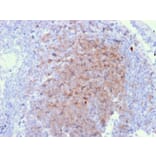 Immunohistochemistry - Anti-CD72 Antibody [BU40] (A250770) - Antibodies.com