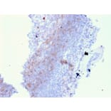 Immunohistochemistry - Anti-CD72 Antibody [BU40] (A250767) - Antibodies.com