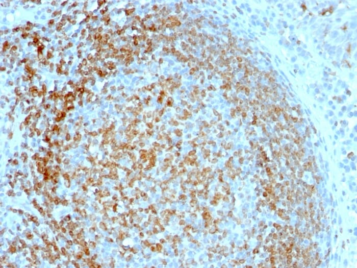 Anti-CD74 Antibody [LN-2] (A250771) | Antibodies.com