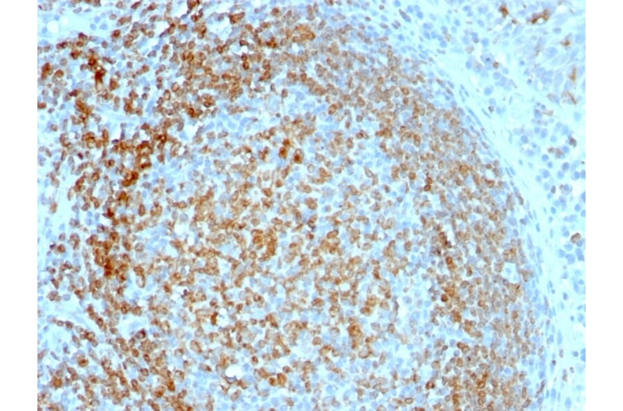 Immunohistochemistry - Anti-CD74 Antibody [LN-2] (A250771) - Antibodies.com