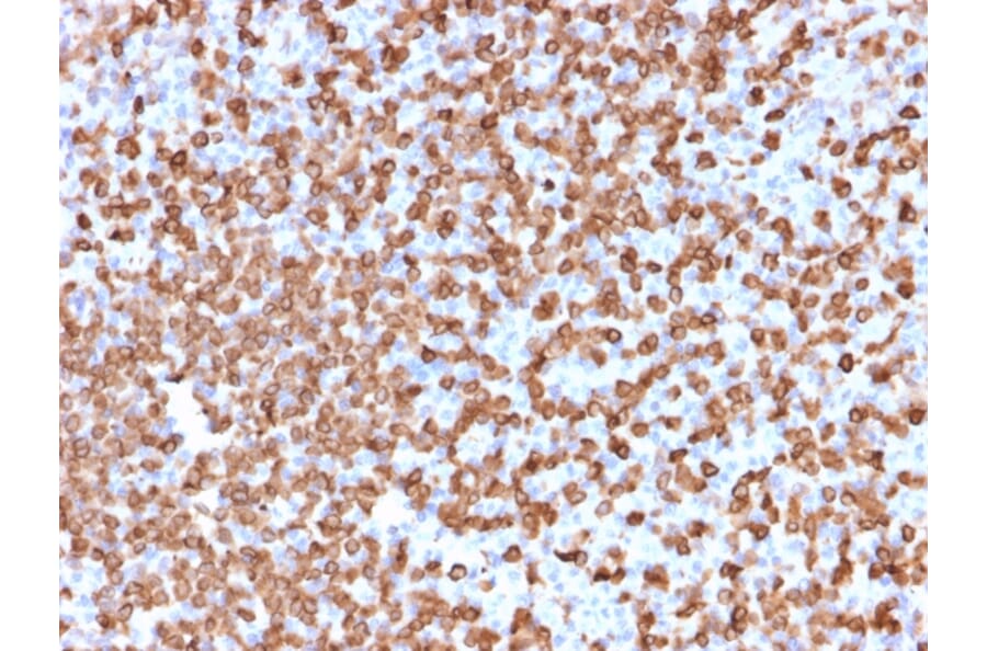 Immunohistochemistry - Anti-CD74 Antibody [LN-2] (A250771) - Antibodies.com