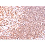 Immunohistochemistry - Anti-CD74 Antibody [SPM523] (A250772) - Antibodies.com