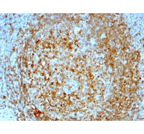 Immunohistochemistry - Anti-CD74 Antibody [CLIP/813] (A250774) - Antibodies.com