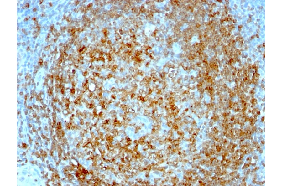 Immunohistochemistry - Anti-CD74 Antibody [CLIP/813] (A250774) - Antibodies.com