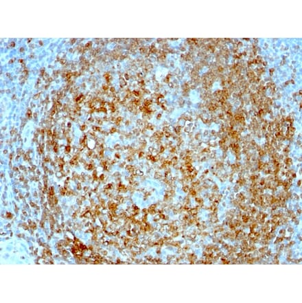Immunohistochemistry - Anti-CD74 Antibody [CLIP/813] (A250774) - Antibodies.com