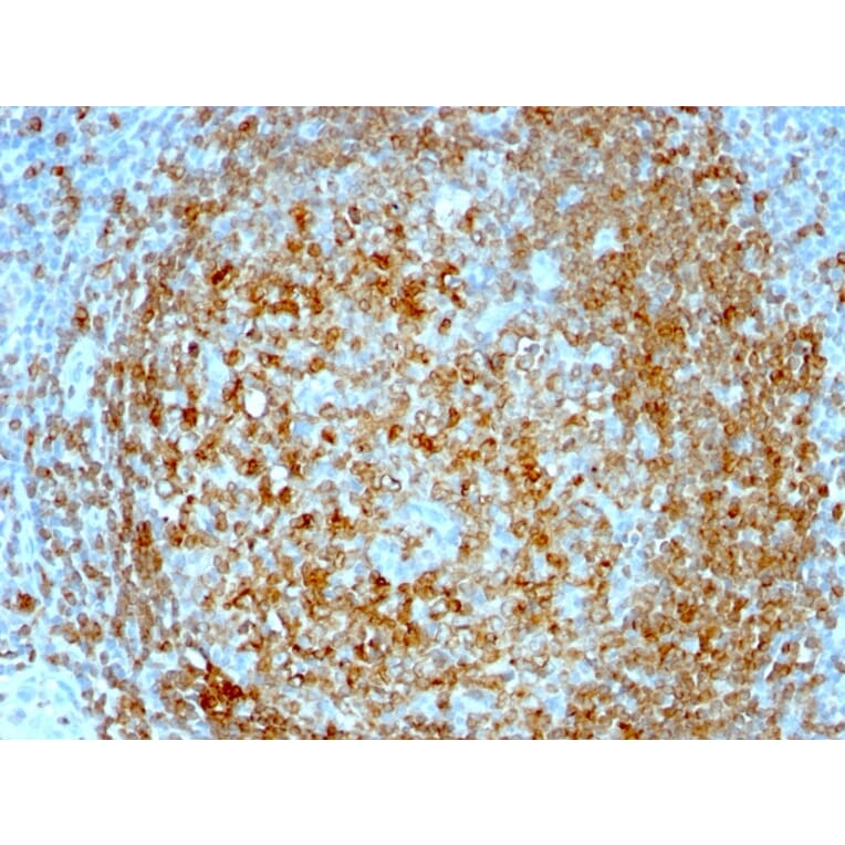 Immunohistochemistry - Anti-CD74 Antibody [CLIP/813] (A250774) - Antibodies.com
