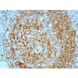 Immunohistochemistry - Anti-CD74 Antibody [CLIP/813] (A250774) - Antibodies.com