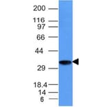 Western Blot - Anti-CD74 Antibody [CLIP/1133] (A250774) - Antibodies.com