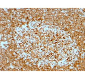 Immunohistochemistry - Anti-CD74 Antibody [LN-2 + CLIP/813] (A250776) - Antibodies.com