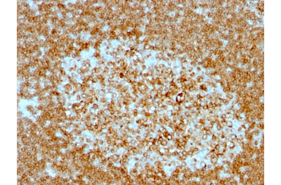 Immunohistochemistry - Anti-CD74 Antibody [LN-2 + CLIP/813] (A250776) - Antibodies.com