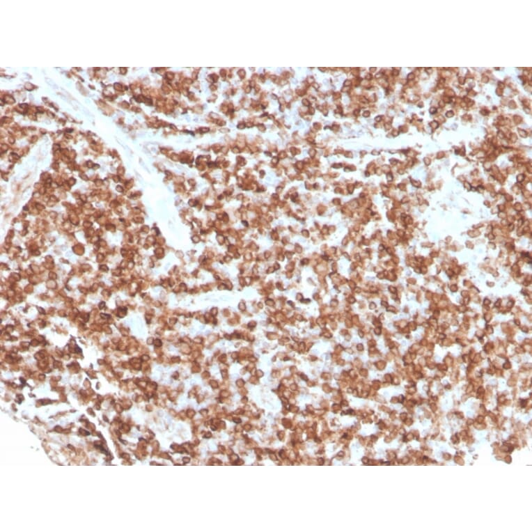 Immunohistochemistry - Anti-CD74 Antibody [rCLIP/813] (A250776) - Antibodies.com