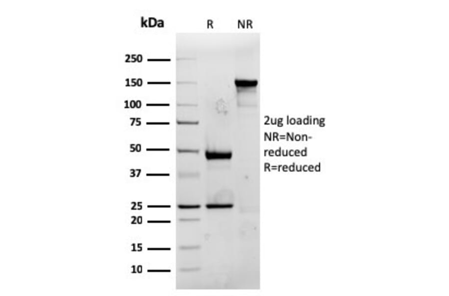 SDS-PAGE - Anti-CD74 Antibody [rCLIP/813] (A250777) - Antibodies.com