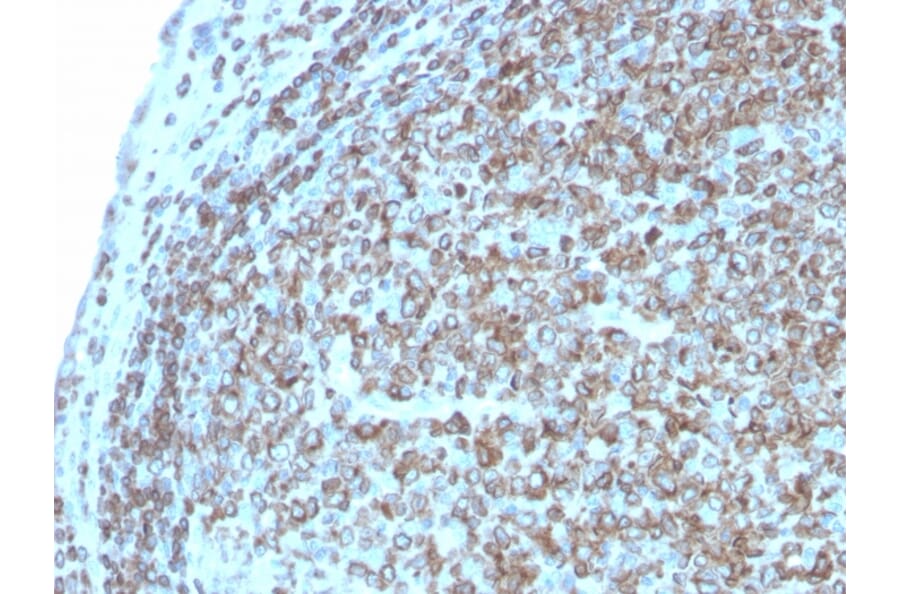 Immunohistochemistry - Anti-CD74 Antibody [CLIP/3127R] (A250778) - Antibodies.com