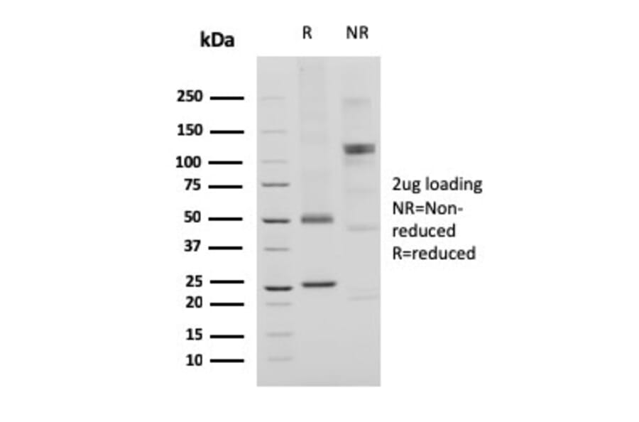 SDS-PAGE - Anti-CD74 Antibody [CLIP/3127R] (A250778) - Antibodies.com