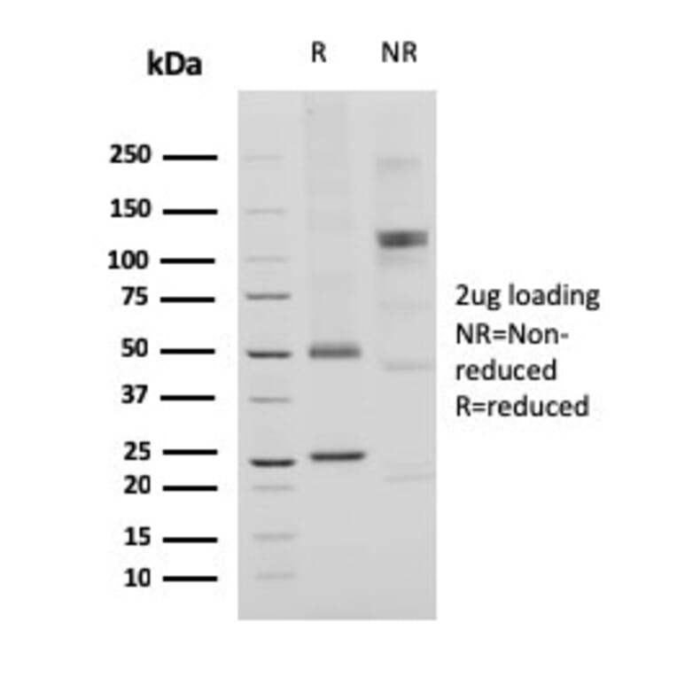 SDS-PAGE - Anti-CD74 Antibody [CLIP/3127R] (A250778) - Antibodies.com