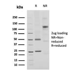 SDS-PAGE - Anti-CD74 Antibody [CLIP/3127R] (A250778) - Antibodies.com