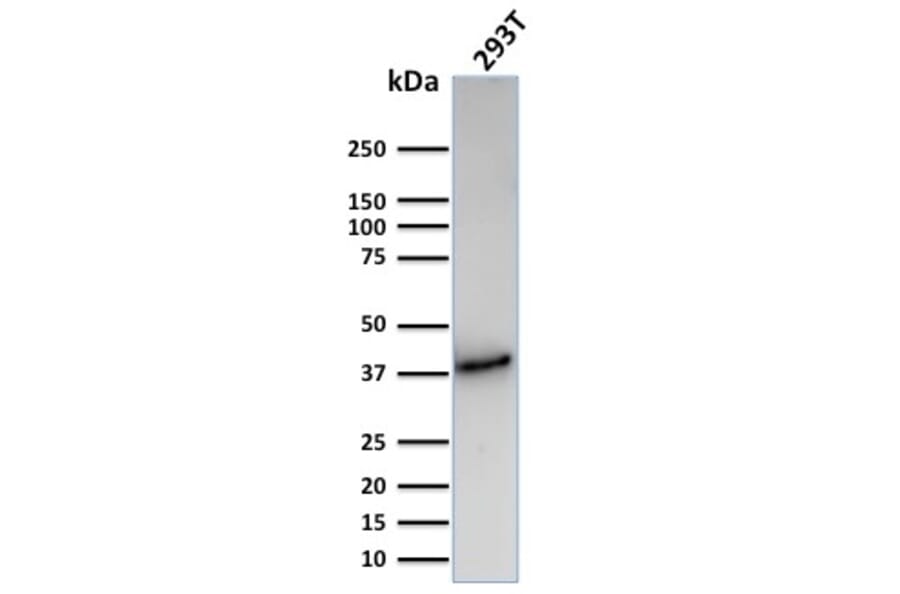 Western Blot - Anti-CD74 Antibody [CLIP/3127R] (A250778) - Antibodies.com