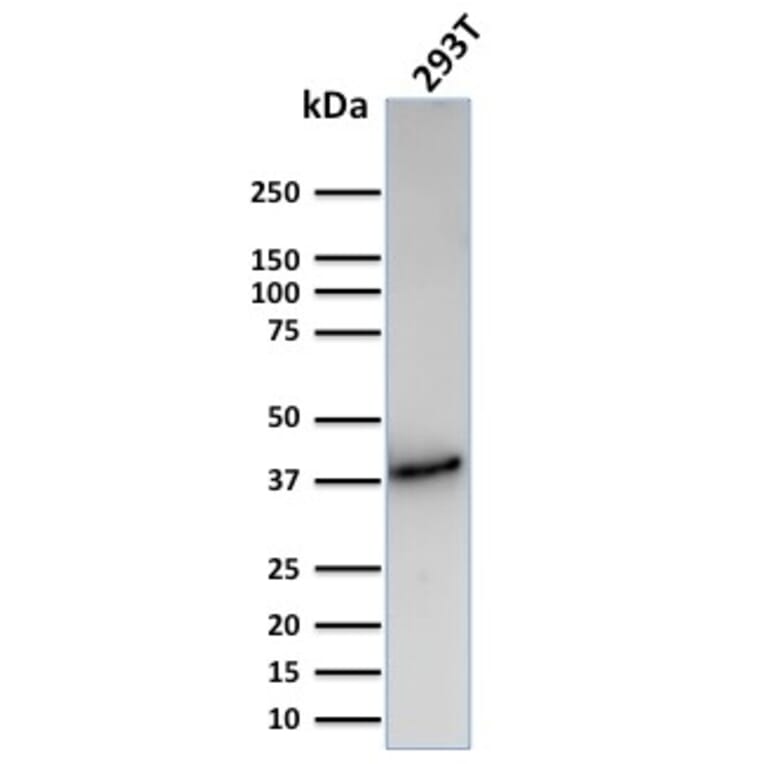 Western Blot - Anti-CD74 Antibody [CLIP/3127R] (A250778) - Antibodies.com