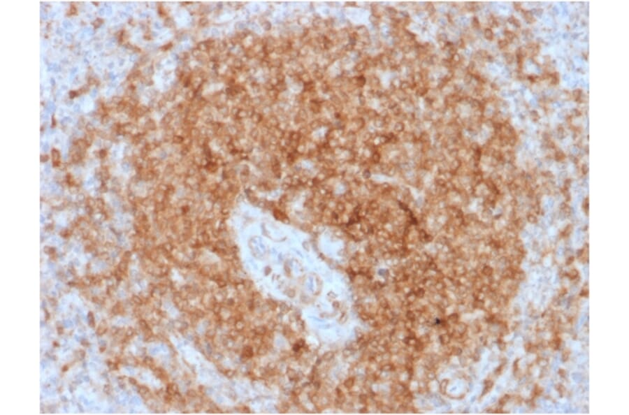 Immunohistochemistry - Anti-CD79a Antibody [rIGA/764] (A250779) - Antibodies.com