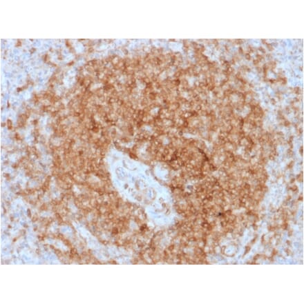 Immunohistochemistry - Anti-CD79a Antibody [rIGA/764] (A250779) - Antibodies.com