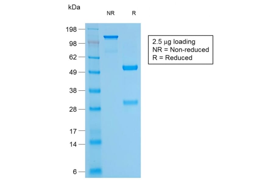 SDS-PAGE - Anti-CD79a Antibody [rIGA/764] (A250779) - Antibodies.com