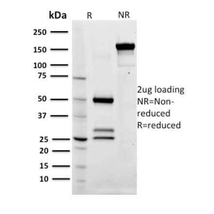 SDS-PAGE - Anti-CD79a Antibody [ZL7-4] (A250780) - Antibodies.com