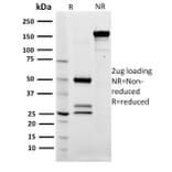 SDS-PAGE - Anti-CD79a Antibody [ZL7-4] (A250780) - Antibodies.com