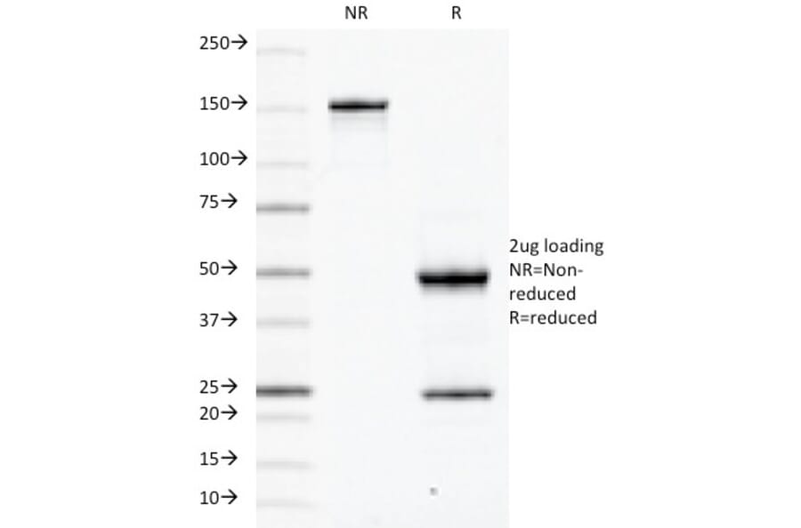 SDS-PAGE - Anti-CD79a Antibody [JCB117] (A250781) - Antibodies.com