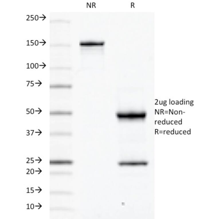 SDS-PAGE - Anti-CD79a Antibody [JCB117] (A250781) - Antibodies.com