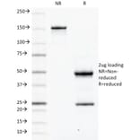 SDS-PAGE - Anti-CD79a Antibody [JCB117] (A250781) - Antibodies.com
