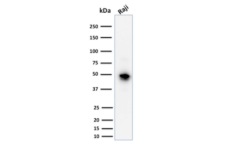 Western Blot - Anti-CD79a Antibody [JCB117] (A250781) - Antibodies.com