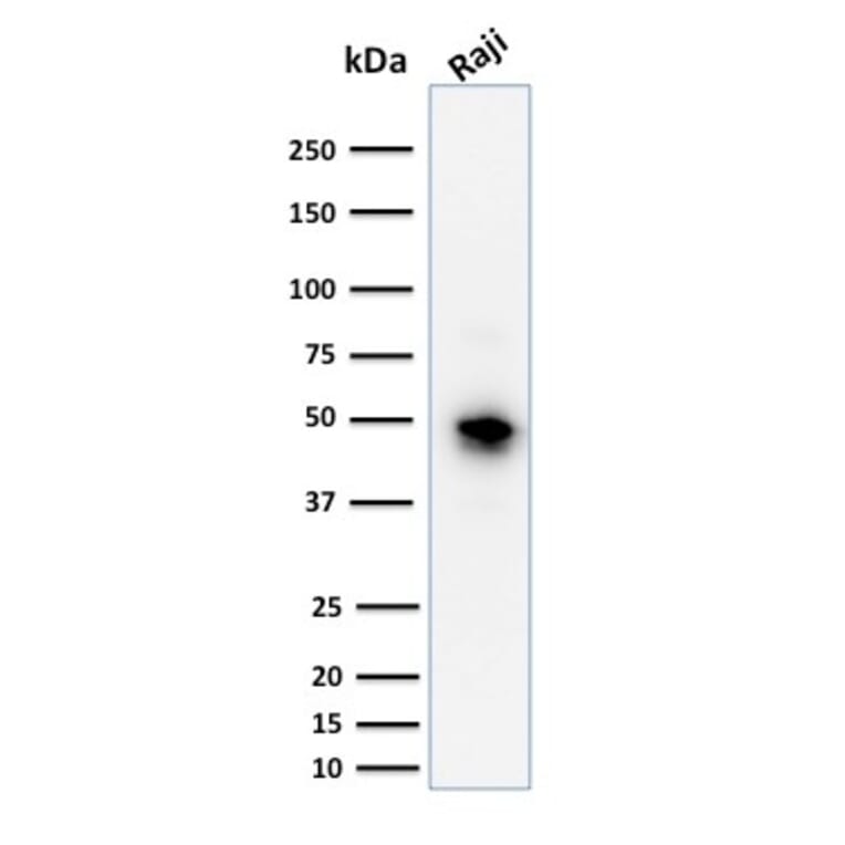 Western Blot - Anti-CD79a Antibody [JCB117] (A250781) - Antibodies.com
