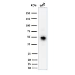 Western Blot - Anti-CD79a Antibody [JCB117] (A250781) - Antibodies.com