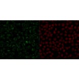 Immunofluorescence - Anti-CD79a Antibody [JCB117] (A250781) - Antibodies.com