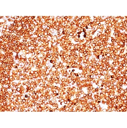Immunohistochemistry - Anti-CD79a Antibody [SPM549] (A250782) - Antibodies.com