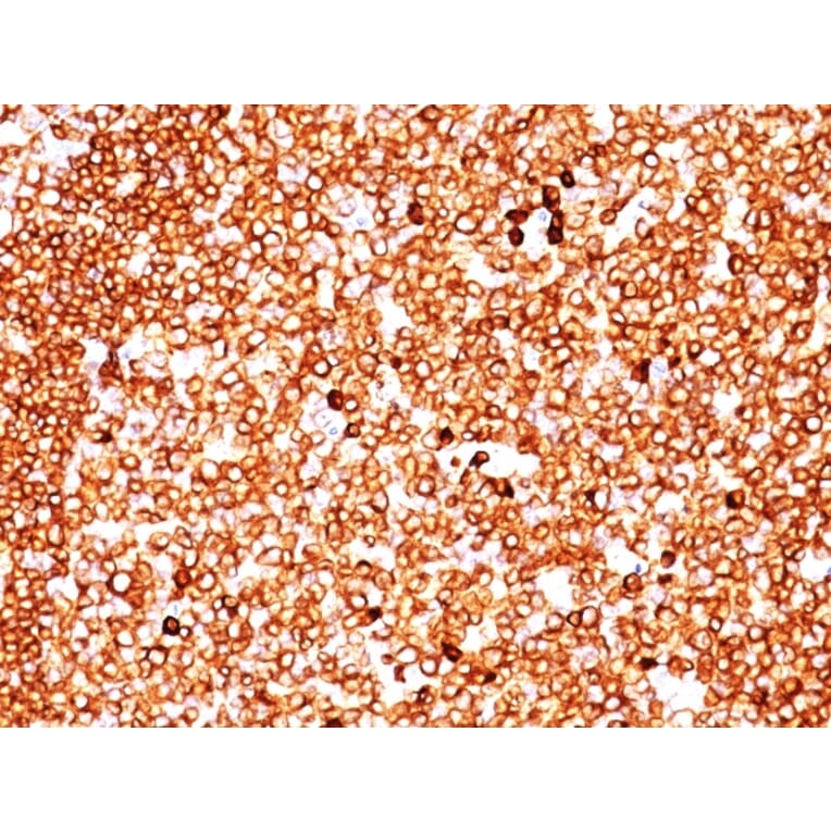 Immunohistochemistry - Anti-CD79a Antibody [SPM549] (A250782) - Antibodies.com