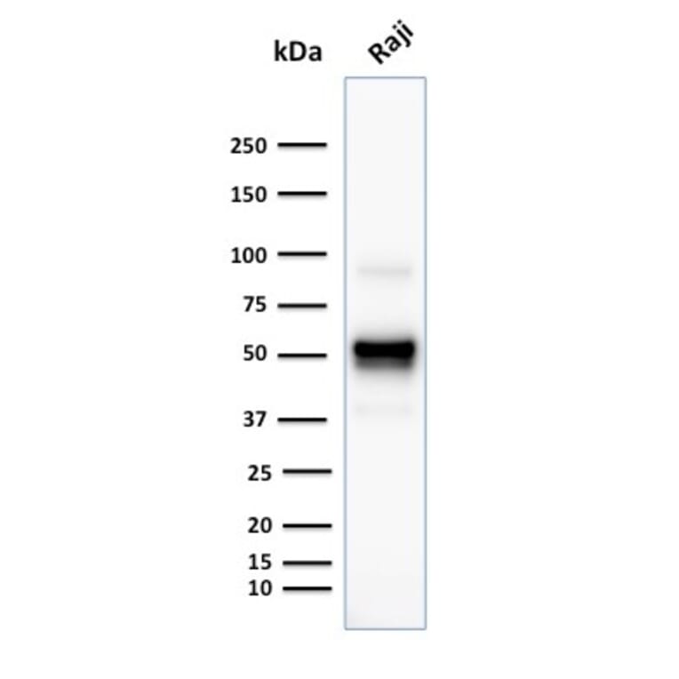 Western Blot - Anti-CD79a Antibody [SPM549] (A250782) - Antibodies.com