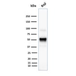 Western Blot - Anti-CD79a Antibody [SPM549] (A250782) - Antibodies.com