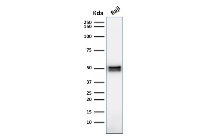 Western Blot - Anti-CD79a Antibody [HM47/A9] (A250783) - Antibodies.com