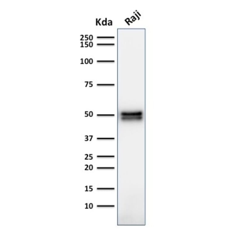 Western Blot - Anti-CD79a Antibody [HM47/A9] (A250783) - Antibodies.com