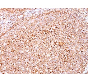 Immunohistochemistry - Anti-CD79a Antibody [SPM550] (A250784) - Antibodies.com
